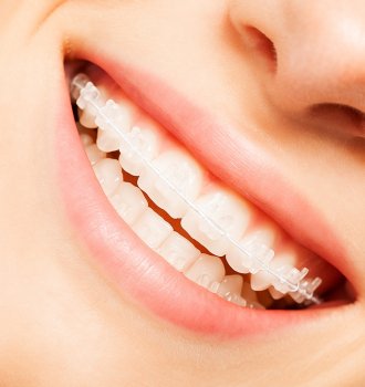 aparat invizibil sapphire